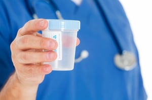 a doctor holding an empty drug testing urine cup 